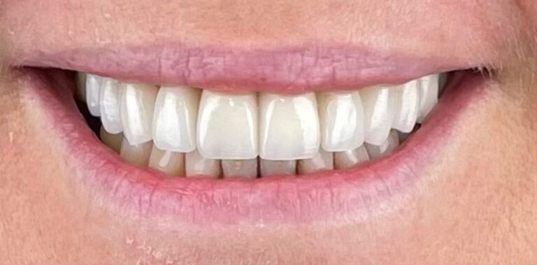 Метаморфоза 90 - po