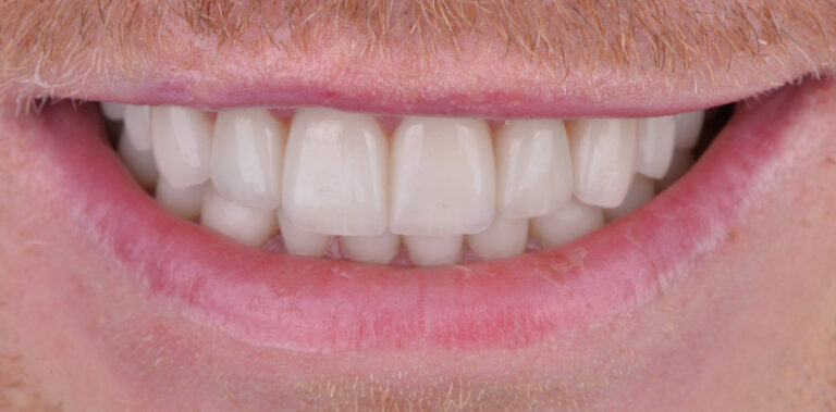 Метаморфоза 13 - po