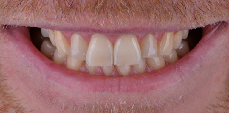 Метаморфоза 13 - przed