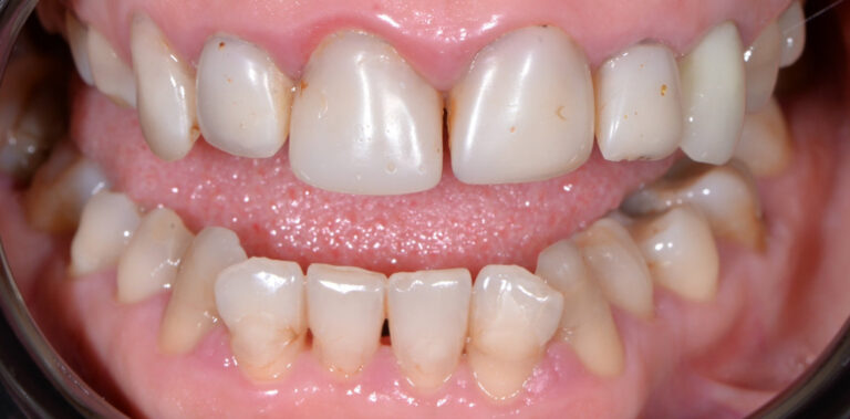 Metamorfoza 73 - przed