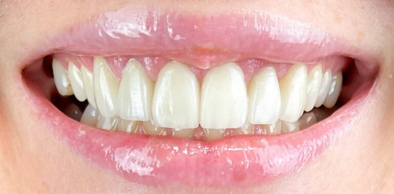 Метаморфоза 52 - po