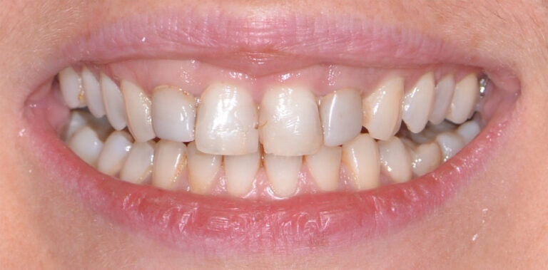 Метаморфоза 52 - przed