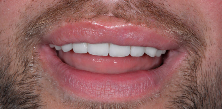 Метаморфоза 91 - po