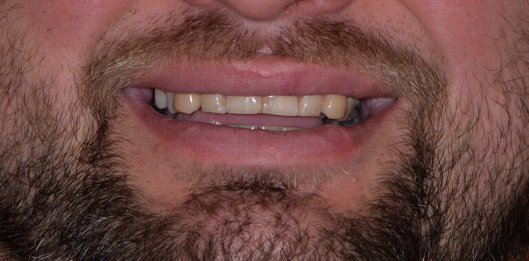 Метаморфоза 91 - przed