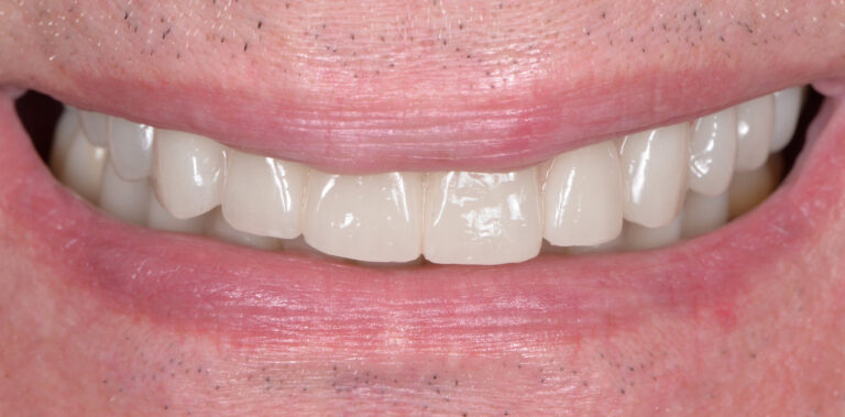 Метаморфоза 53 - po