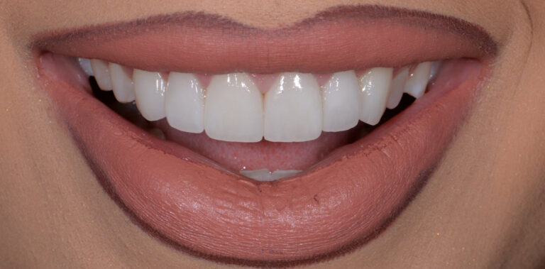 Метаморфоза 11 - po