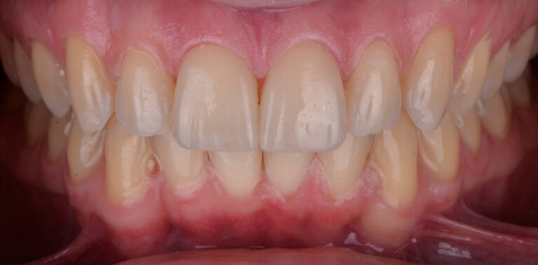 Метаморфоза 4 - po