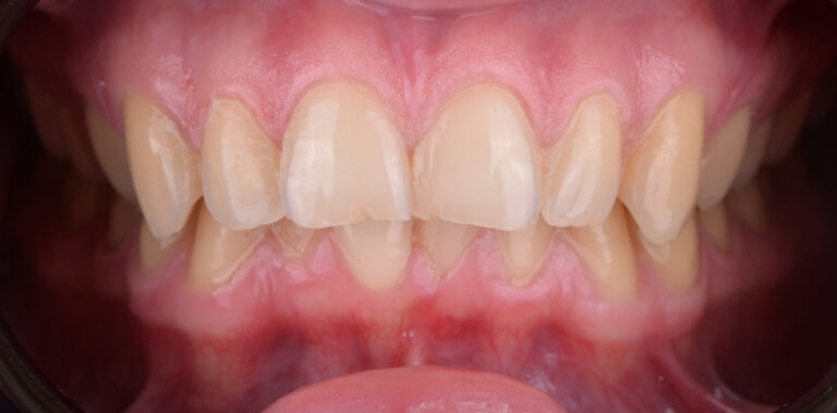 Метаморфоза 4 - przed