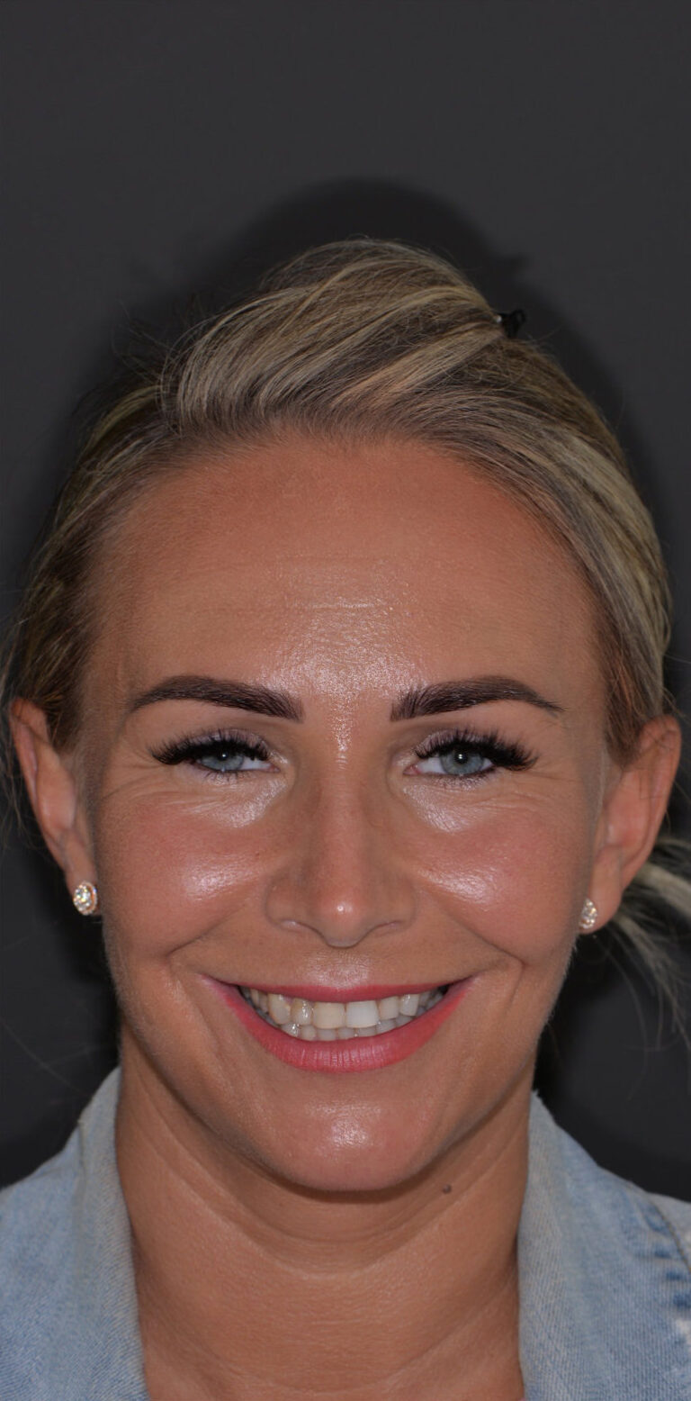 Метаморфоза 104 - przed