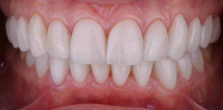 Метаморфоза 8 - po