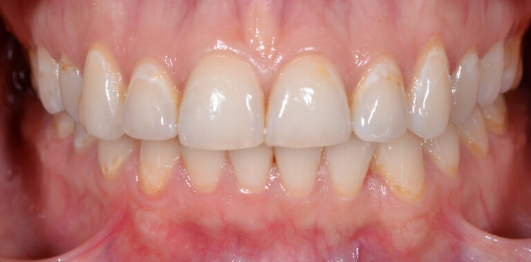 Метаморфоза 8 - przed