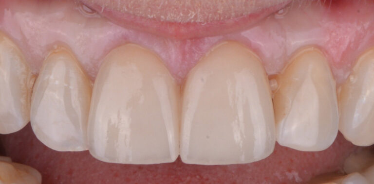 Метаморфоза 57 - po