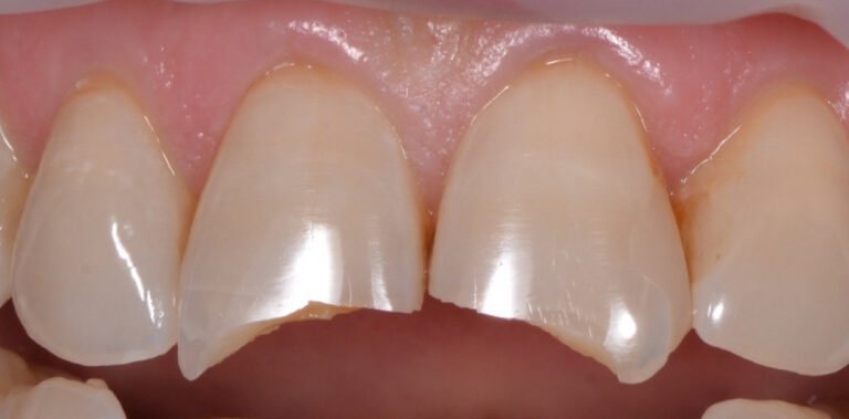 Метаморфоза 57 - przed