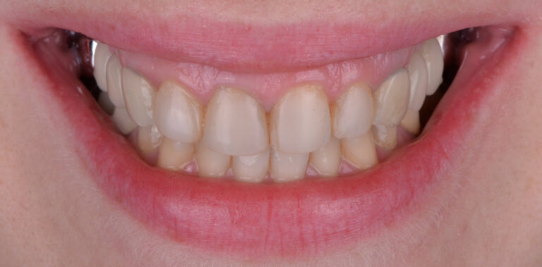 Метаморфоза 45 - przed