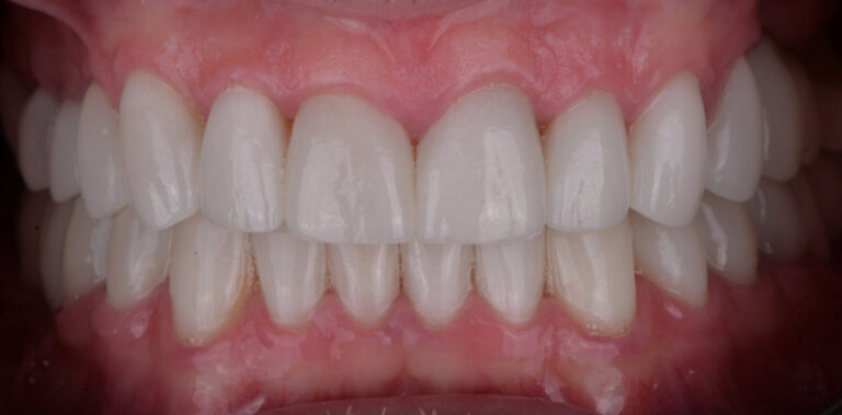 Метаморфоза 78 - po