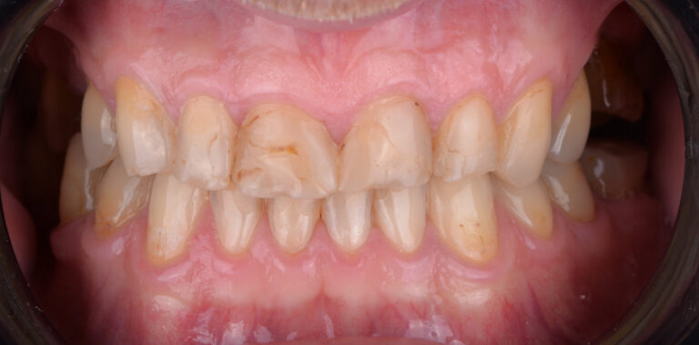 Метаморфоза 78 - przed