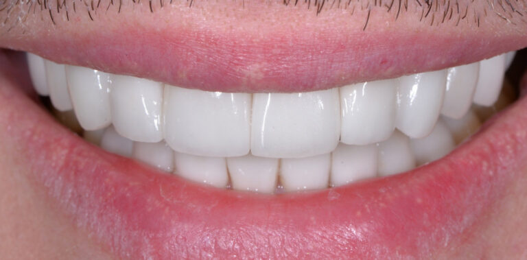 Метаморфоза 74 - po