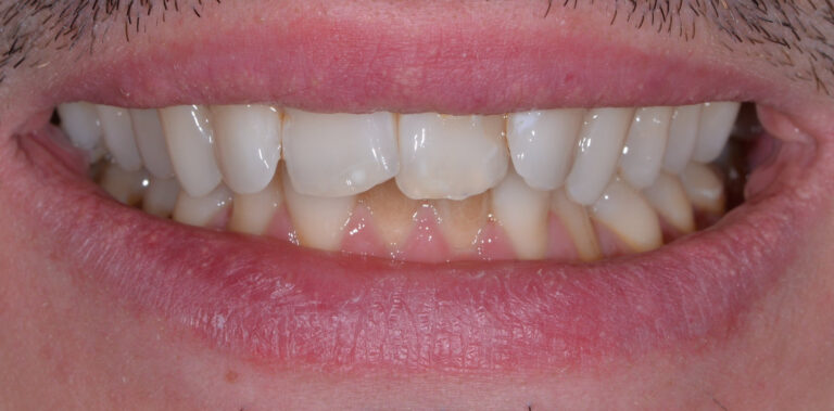 Метаморфоза 74 - przed