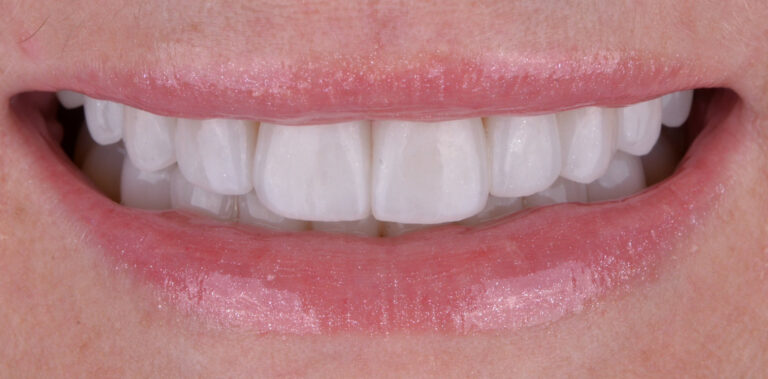 Метаморфоза 29 - po