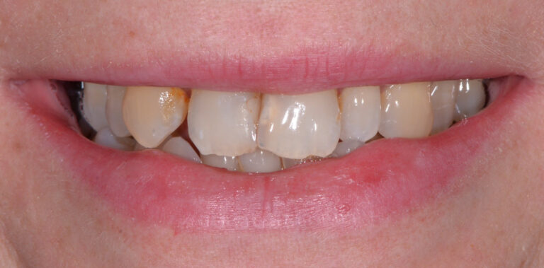 Метаморфоза 29 - przed