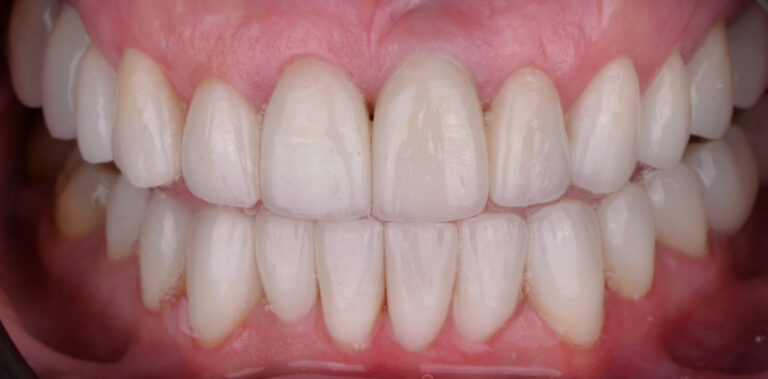 Метаморфоза 60 - po