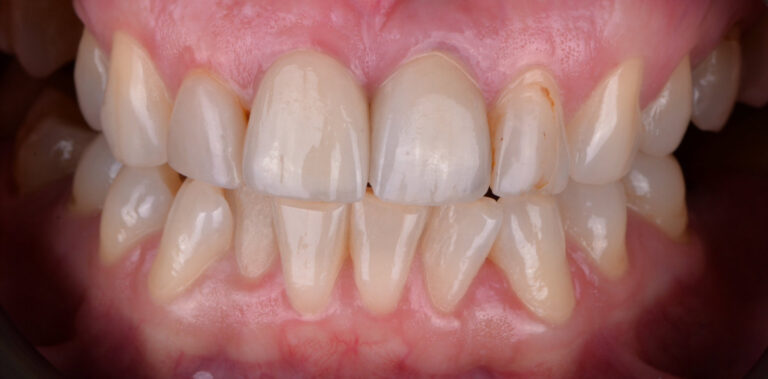 Метаморфоза 60 - przed