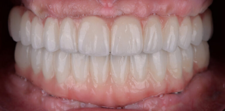 Метаморфоза 10 - po