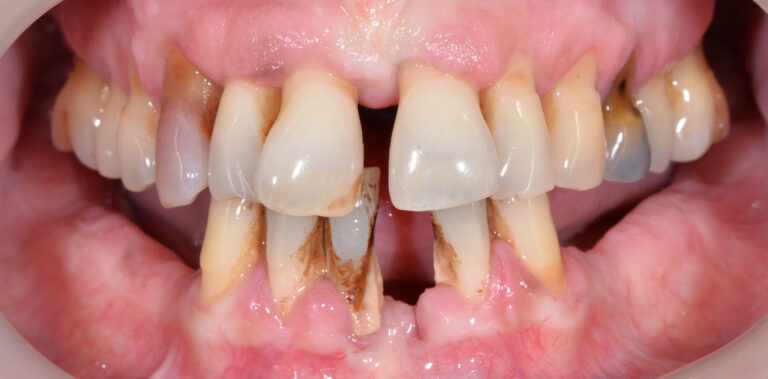 Метаморфоза 10 - przed