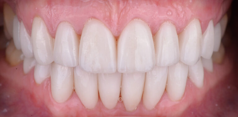 Метаморфоза 24 - po