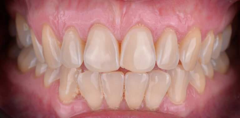 Метаморфоза 24 - przed