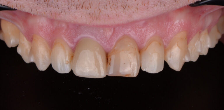 Метаморфоза 56 - przed