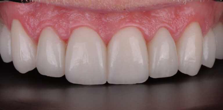 Метаморфоза 14 - po