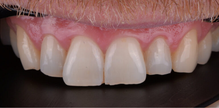 Метаморфоза 14 - przed