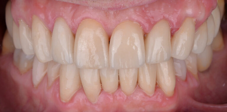 Метаморфоза 89 - po