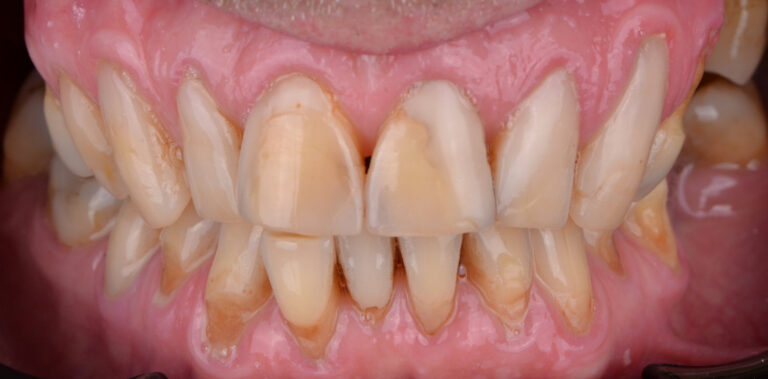 Метаморфоза 89 - przed