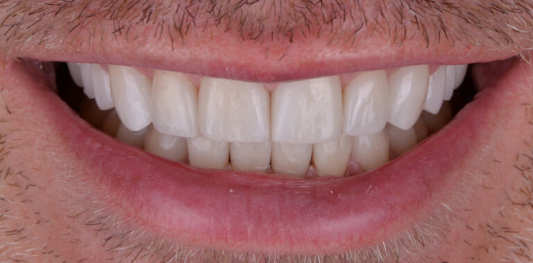 Метаморфоза 51 - po