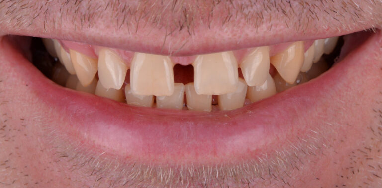 Метаморфоза 51 - przed