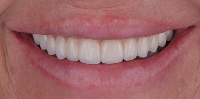 Метаморфоза 9 - po