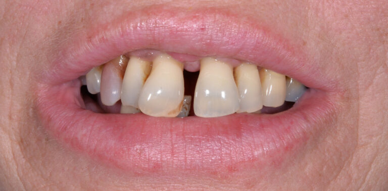 Метаморфоза 9 - przed