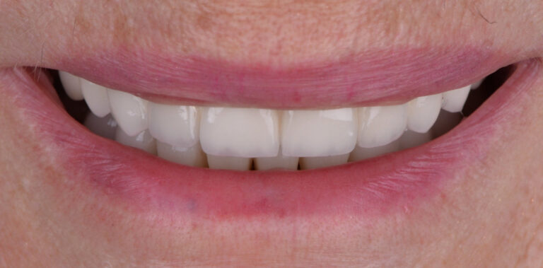 Метаморфоза 80 - po