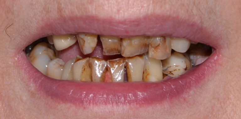 Метаморфоза 80 - przed