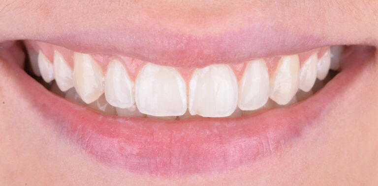 Метаморфоза 39 - po