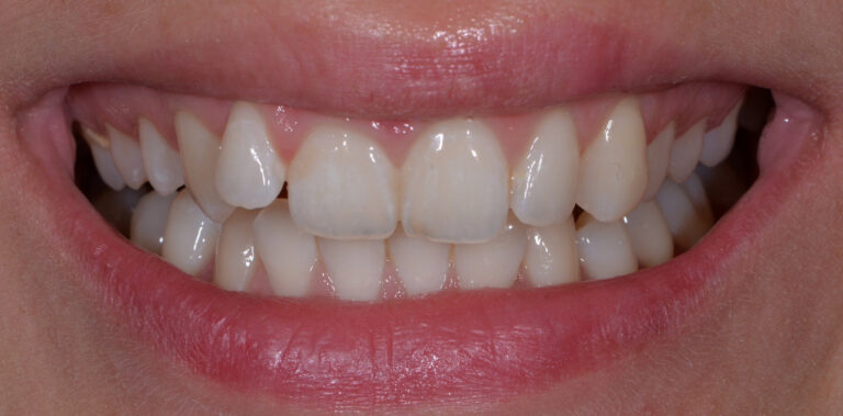 Метаморфоза 39 - przed