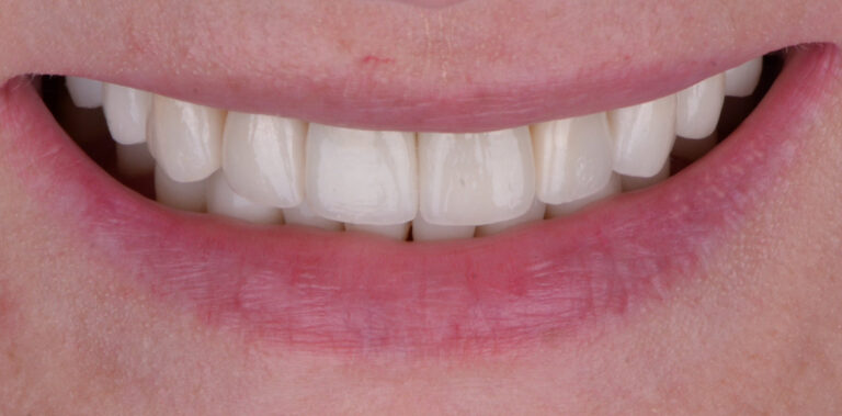 Метаморфоза 59 - po