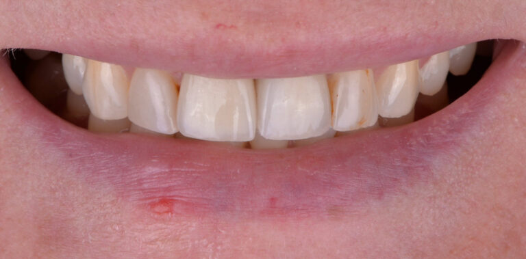 Метаморфоза 59 - przed