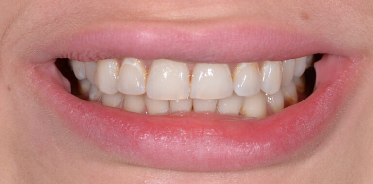 Метаморфоза 7 - przed