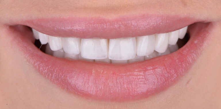 Метаморфоза 7 - po