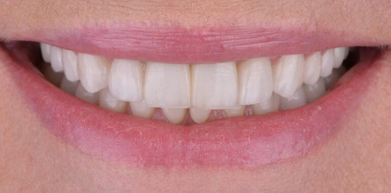 Метаморфоза 31 - po