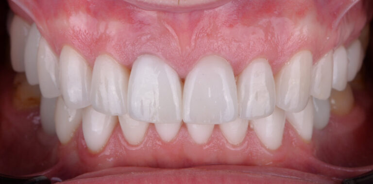 Метаморфоза 55 - po