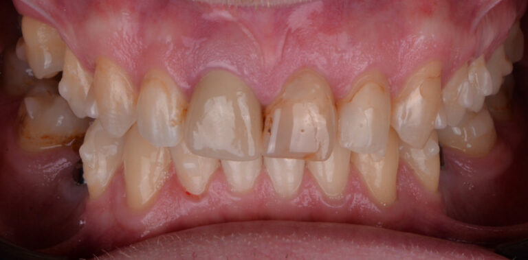 Метаморфоза 55 - przed